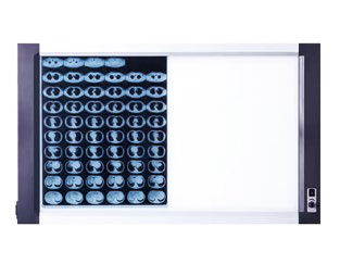 X-ray film viewing light with a film on the left and illuminated area on the right